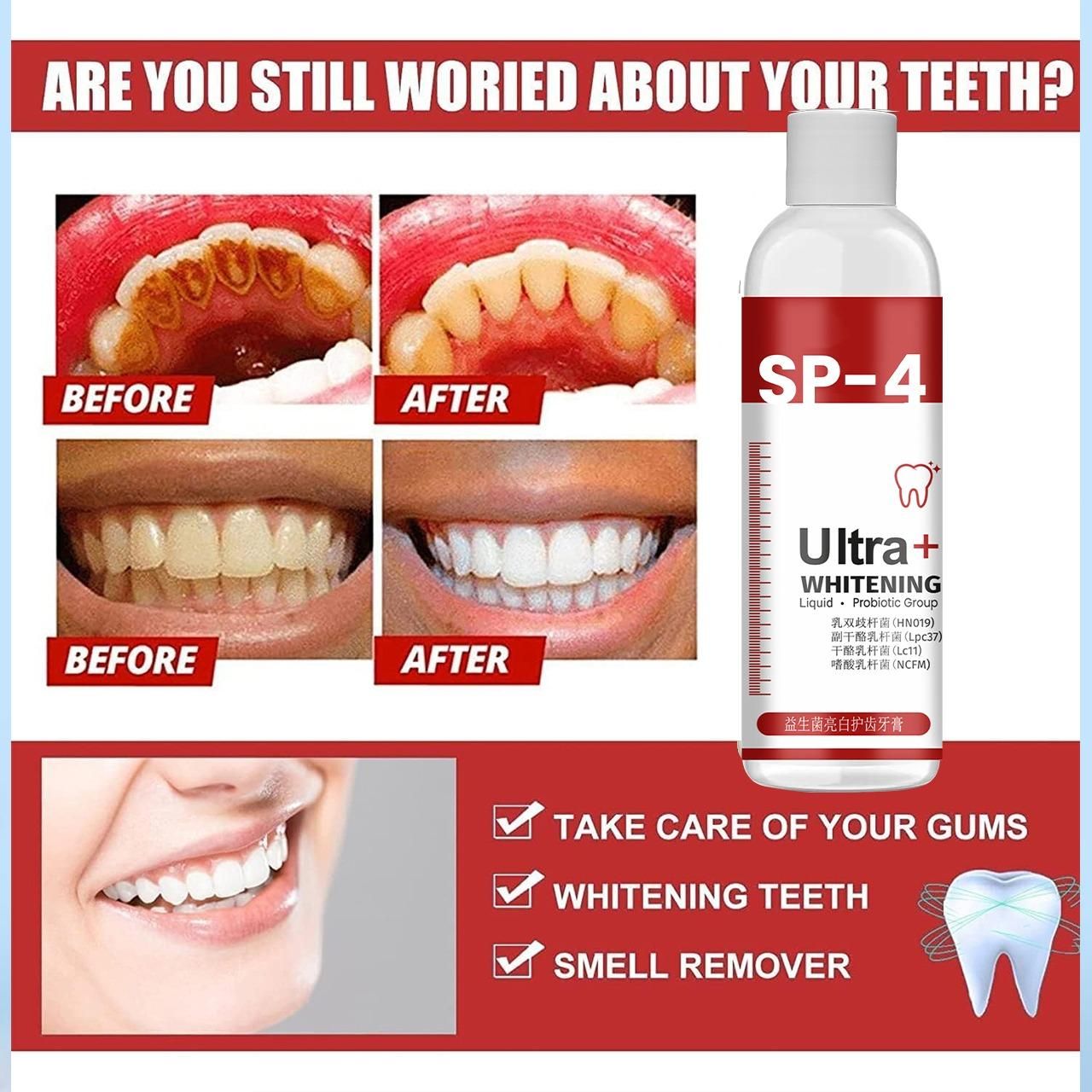 SP-4 Ultra+ Whitening Teeth